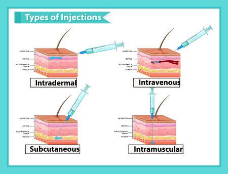 Scientific medical illustration of types of injections illustrationのイラスト素材