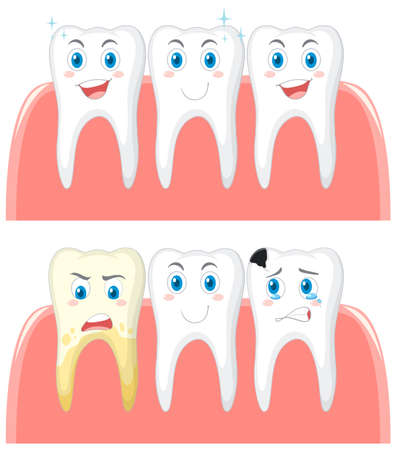Set of strong teeth and tooth decay on white background illustrationのイラスト素材
