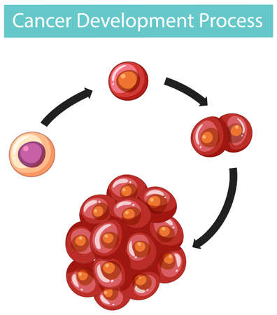 Cancer Development Process infographic  illustrationのイラスト素材