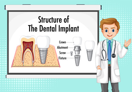Infographic of human in structure of the dental implant illustrationのイラスト素材