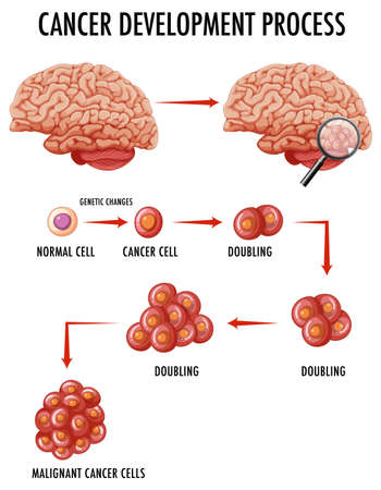 Diagram showing cancer development process illustrationのイラスト素材