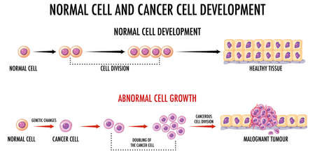 Diagram showing normal and cancer cells illustrationのイラスト素材