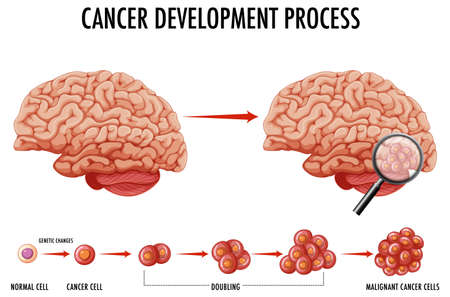 Diagram showing human brain and cancer illustrationのイラスト素材