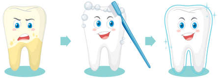 Teeth cleaning procedure on white background illustrationのイラスト素材