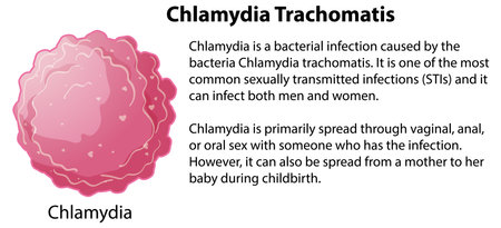 Chlamydia Trachomatis with explanation illustrationのイラスト素材