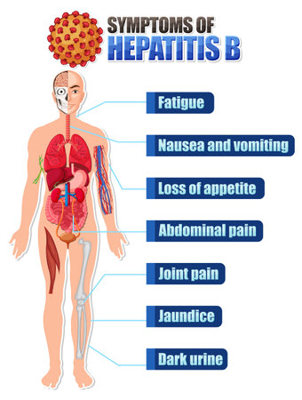 Informative poster of common symptoms Hepatitis B illustrationのイラスト素材