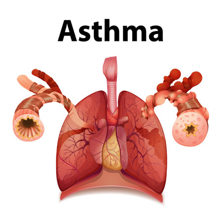 An informative infographic comparing normal and asthma lungs in a medical education contextのイラスト素材