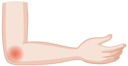 Vector image of an elbow with painのイラスト素材