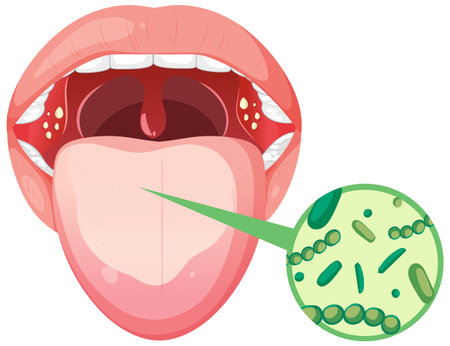 Illustration of mouth bacteria and oral healthのイラスト素材