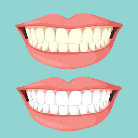 Illustration showing teeth whitening transformationのイラスト素材