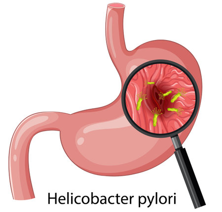 Vector stomach cross-section with magnified Helicobacter pylori bacteria, flat style, medical educational graphicのイラスト素材