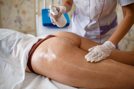 Body treatment: woman getting rf lifting procedure to her buttocks. Perfect shape buttocks on...