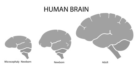 Silhouette image of human brain adult, newborn child with a normal brain and severe microcephaly. Virus of Zika.  Flat designの写真素材