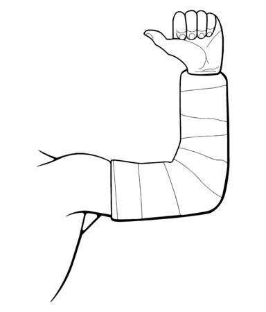 Male hand in a plaster cast. Fracture and healing. Vector illustration.のイラスト素材