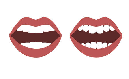 Smiling woman mouth with perfect and imperfect teeth. Vector flat design