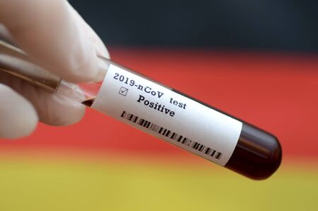 Coronavirus 2019-nCoV Blood Sample. Epidemic virus Respiratory Syndrome stock photo . Corona virus outbreak in Germany. Stock photo of holding tube with Blood Test(novel Coronavirus 2019 disease,COVID-19,nCoV)の写真素材