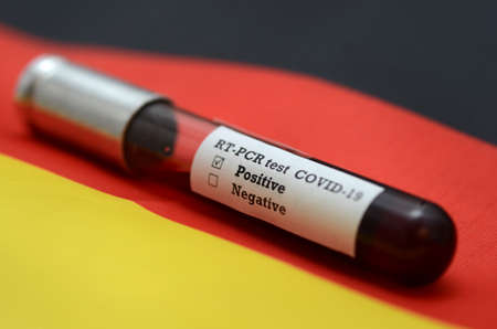 Coronavirus 2019-nCoV Blood Sample. Epidemic virus Respiratory Syndrome stock photo.の写真素材