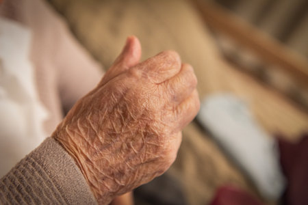 Parkinson's disease. An elderly woman's handの写真素材