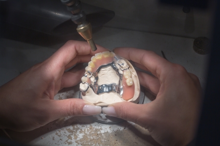 Dental technician manufacturing a prosthesis with a laserの写真素材
