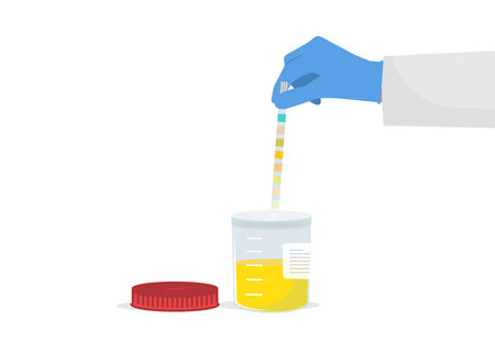 Urine analysis. Doctor in gloves holds an indicator strip in hands stock illustration. The doctor uses a urine test strip stock illustrationのイラスト素材