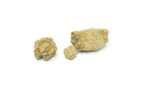 Gallstones - small stones, usually made of cholesterol, that form in the gallbladder