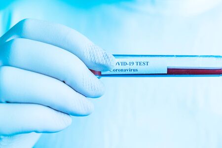 Coronavirus test in laboratory. Covid 19. Arm in plastic gloves holding test tube with test sample in laboratory. Hand detail. Blue tone filter.の写真素材