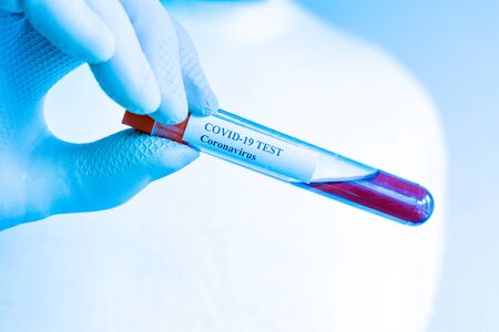 Coronavirus test in laboratory. Covid 19. Arm in plastic gloves holding test tube with test sample in laboratory. Hand detail. Blue tone filter.の写真素材