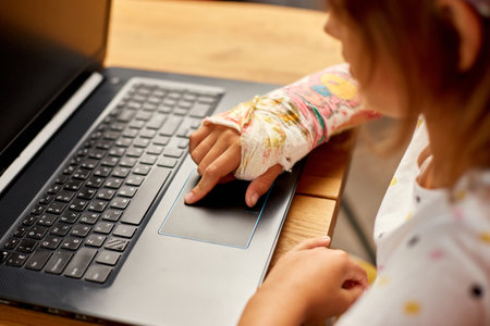 Teen girl with a broken arm orthopedic cast studying online on laptop at home