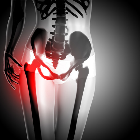 3D render of a female figure with hip in painの写真素材