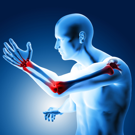 3d illustration of a medical figure with painful elbowの写真素材