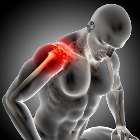 3D render of a male medical figure with painful shoulder joints highlightedの写真素材