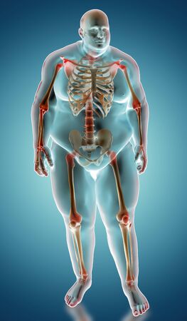 3d illustration of Overweight human anatomy with heighleited painful jointsの写真素材