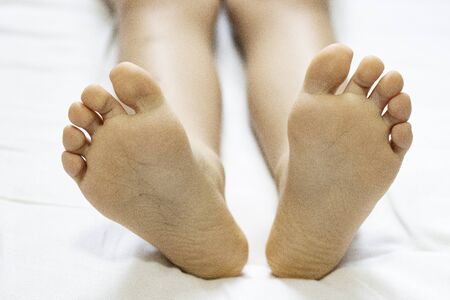 children's heels on a white bed close-up. feet of a child with flat feet lying in bedの写真素材