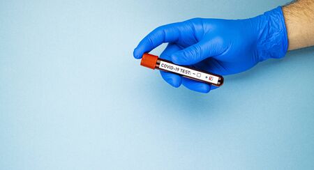 a man's hand in a blue medical glove holds an ampoule of blood with a positive test for covid-19. passing a test for the presence of coronavirus, space for textの写真素材