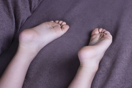 Children's bare feet on the bed. Your feet are lying on the bed with your heels up. Platypodia....