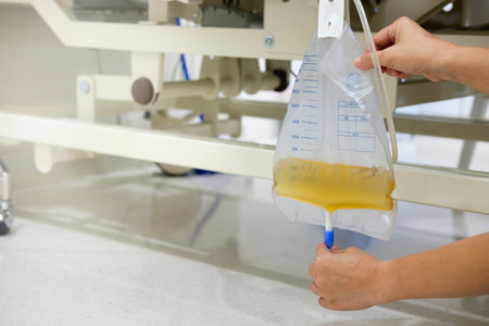 Hand holding urine or pee catheter bag hang under patient bed in hospitalの写真素材