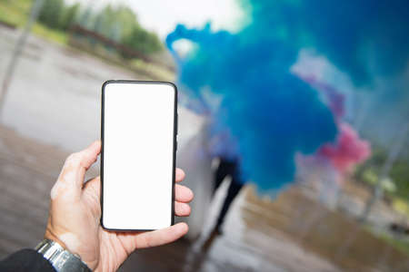 the left hand with vitiligo pigmentation disorder holds the phoneの写真素材