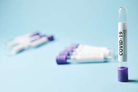 Swab sample on coronavirus Covid 19 in medical tube on blue background. Corona virus research laboratory, vaccine against 2019-nCoV.の写真素材