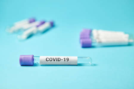 Patient sample of corona virus. Blood testing tubes. Coronavirus covid 19.の写真素材