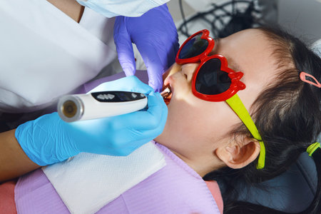 Dentist Remove Caries of Child Girl Using Drill, Close Upの写真素材