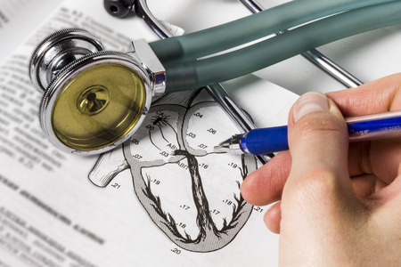 The study of the principles of auscultation cardiologist. Focus on phonendoscope.の写真素材