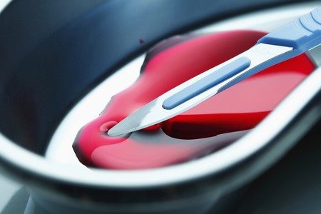 Scalpel in kidney dish with bloodの写真素材