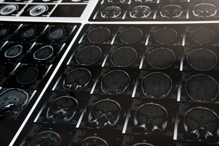 MRI scansの写真素材