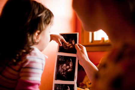 Mother and daughter looking at scan of baby