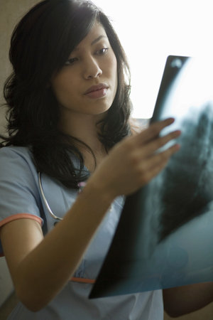 Female Doctor looking at x-rayの写真素材