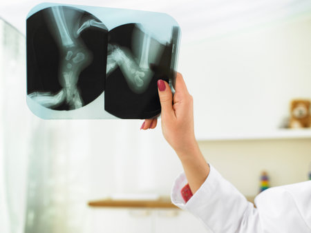 Hand holding X-rayの写真素材