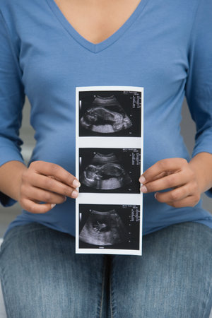 A pregnant woman holding a scanの写真素材