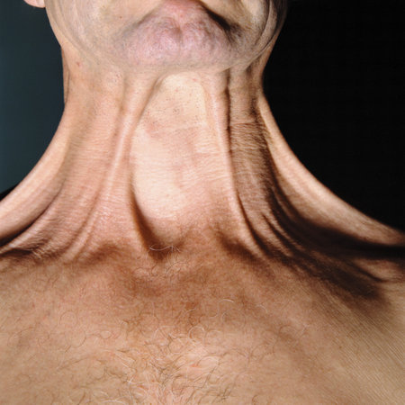 Male neck