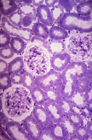 Glomeruli and tubules in kidney