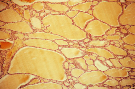 Follicles of colloid in the thyroidの写真素材